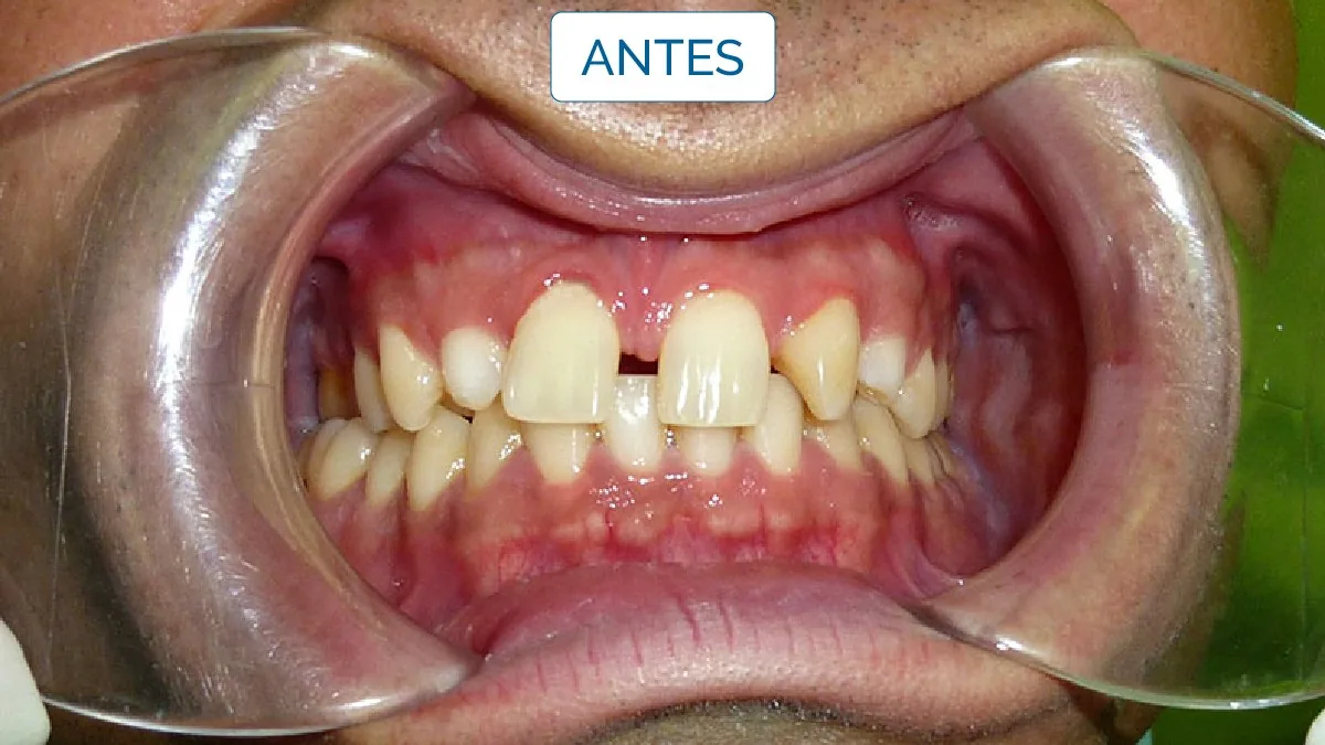 Implantologia — LusoClinic