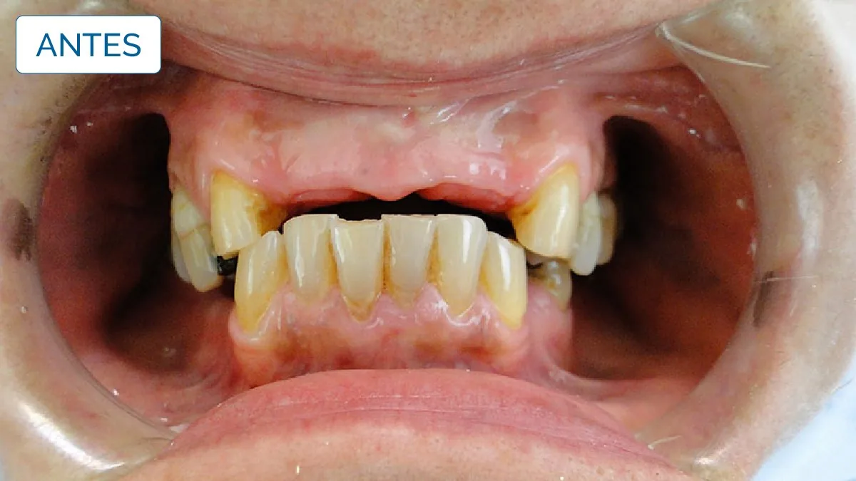 Implantologia — LusoClinic (9)