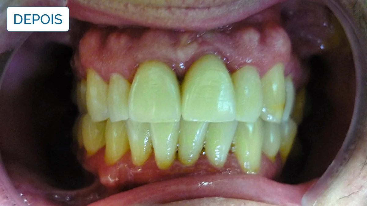 Implantologia — LusoClinic (10)