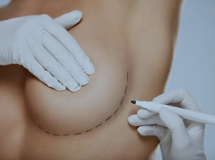 Cirurgia Plástica